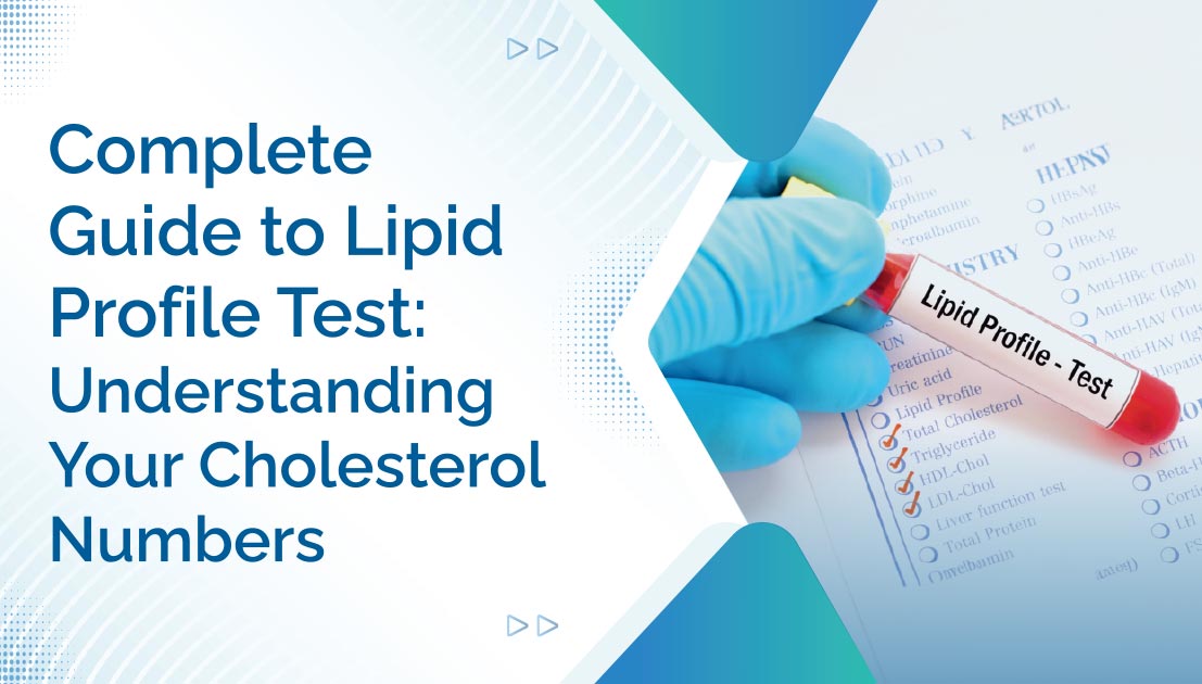Complete Guide to Lipid Profile Test: Understanding Your Cholesterol Numbers