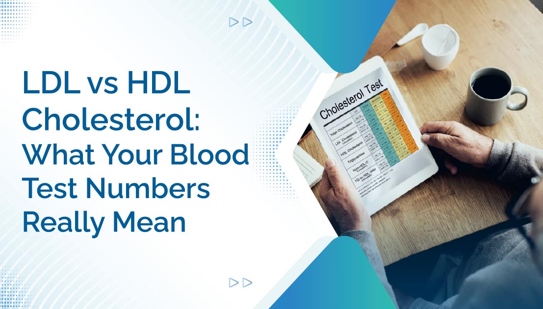 LDL vs HDL Cholesterol: What Your Blood Test Numbers Really Mean