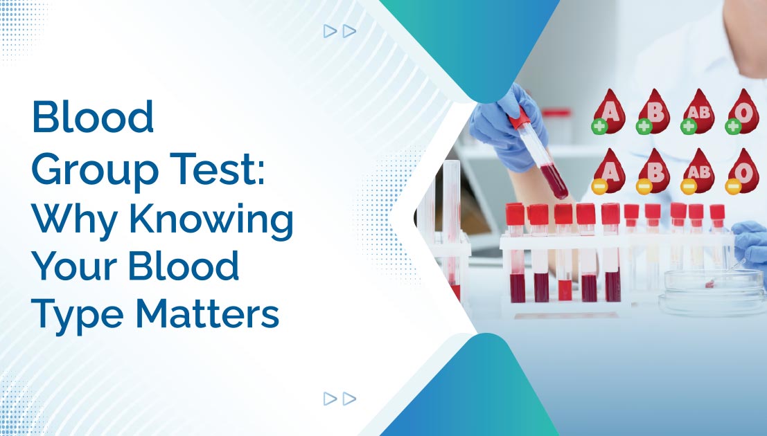 Blood Group Test: Why Knowing Your Blood Type Matters