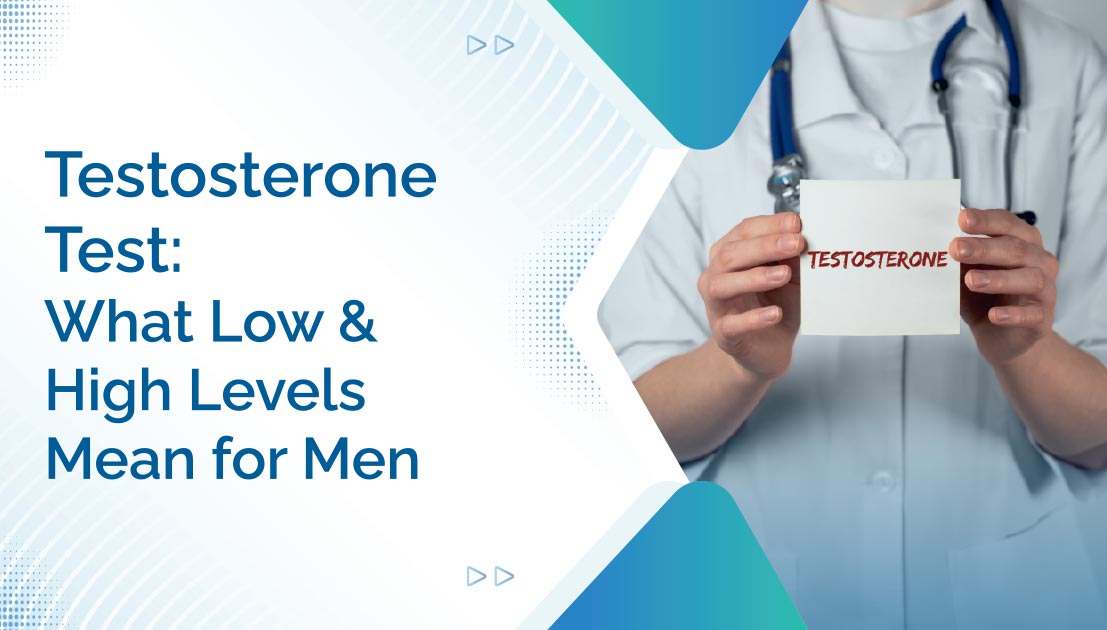 Testosterone Test: What Low and High Levels Mean for Men