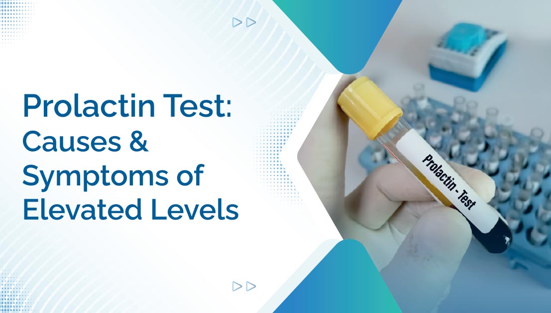 Prolactin Test: Causes and Symptoms of Elevated Levels