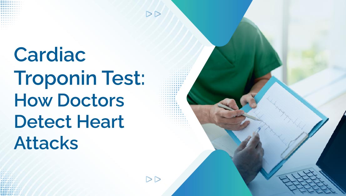 Cardiac Troponin Test: How Doctors Detect Heart Attacks