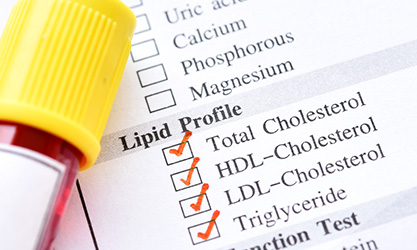 What is Lipid Profile Test?