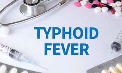 Typhoid Fever: Signs, Symptoms, Causes, Stages & How Long Does It Last