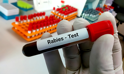 Rabies: Definition, Symptoms, Causes, Diagnosis