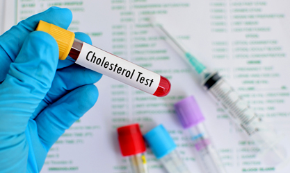 Cholesterol test: Control Your Cholesterol, Control Your Health