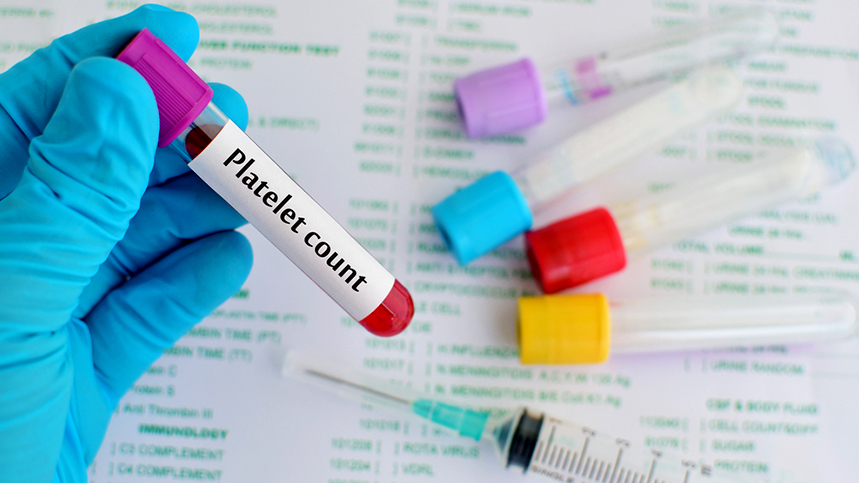 Platelet Count: What It Reveals About Your Health