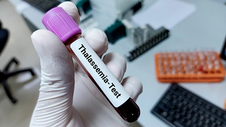 Thalassemia Carrier Screening: Who Should Consider It ?
