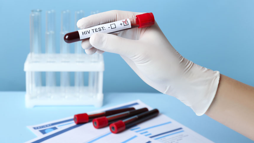 Bloodborne Pathogens: Testing for HIV, Hepatitis, and More