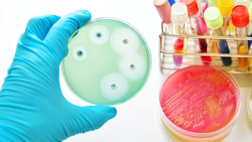 The Importance of Antibiotic Sensitivity Testing in Microbiology
