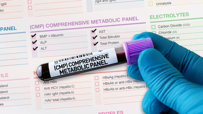 Comprehensive Metabolic Panel: Exploring Essential Blood Tests