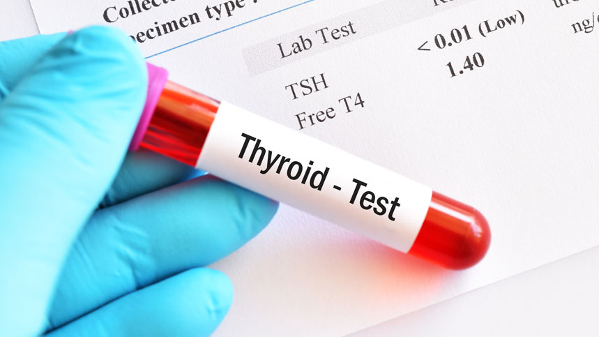 TSH, T3, and T4: Interpreting Thyroid Hormone Tests