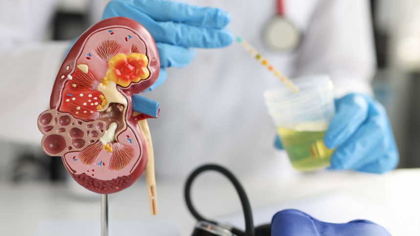 Urinalysis: A Window into Kidney Function