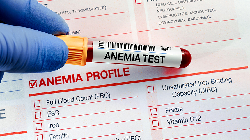 Anaemia in Chronic Kidney Disease: A comprehensive guide