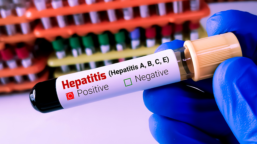 Hepatitis Serology: Detecting Viral Hepatitis Infections