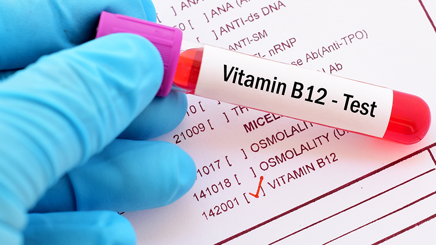 Vitamin B12 Deficiency: Symptoms and Testing