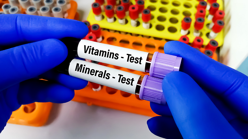 Vitamin Testing: Ensuring You Get Essential Nutrients