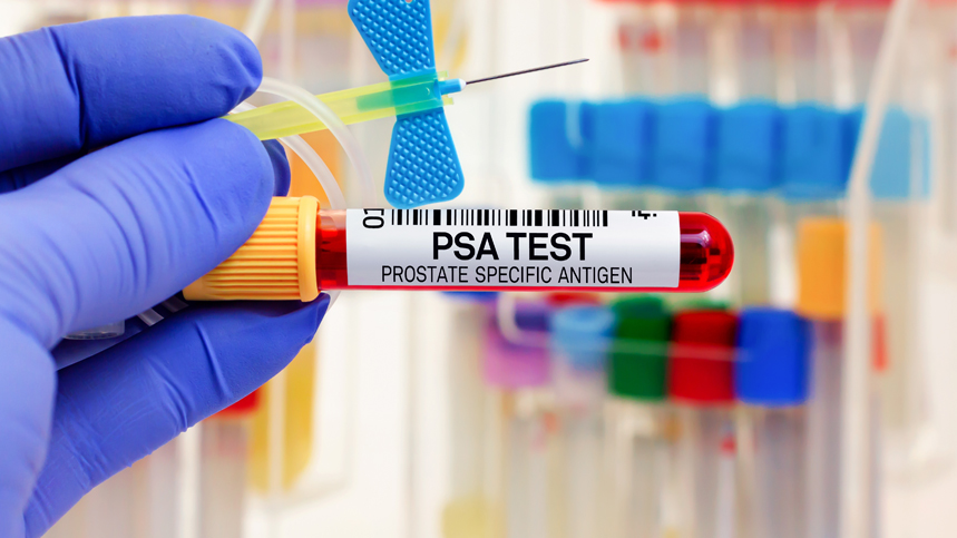 Everything You Need to Know About Prostate-Specific Antigen (PSA)