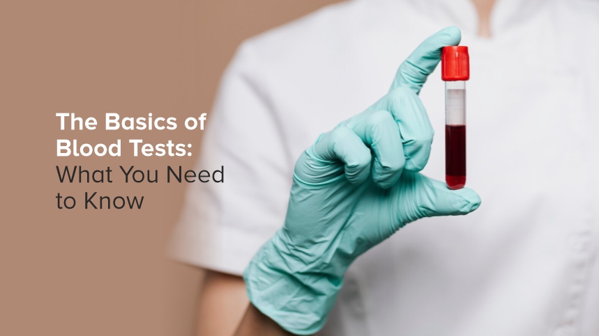 The Basics of Blood Tests: What You Need to Know
