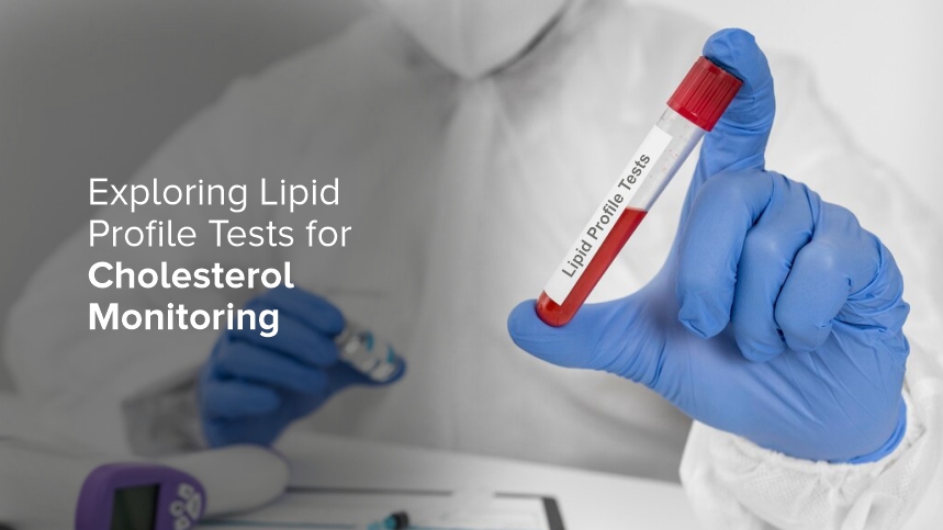 Exploring Lipid Profile Tests for Cholesterol Monitoring