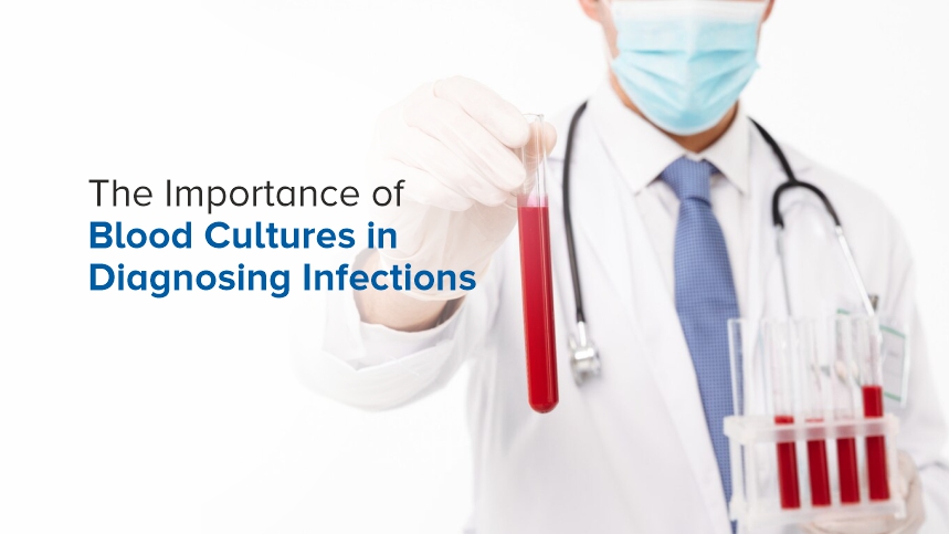 The Crucial Role of Blood Cultures in Diagnosing Infections