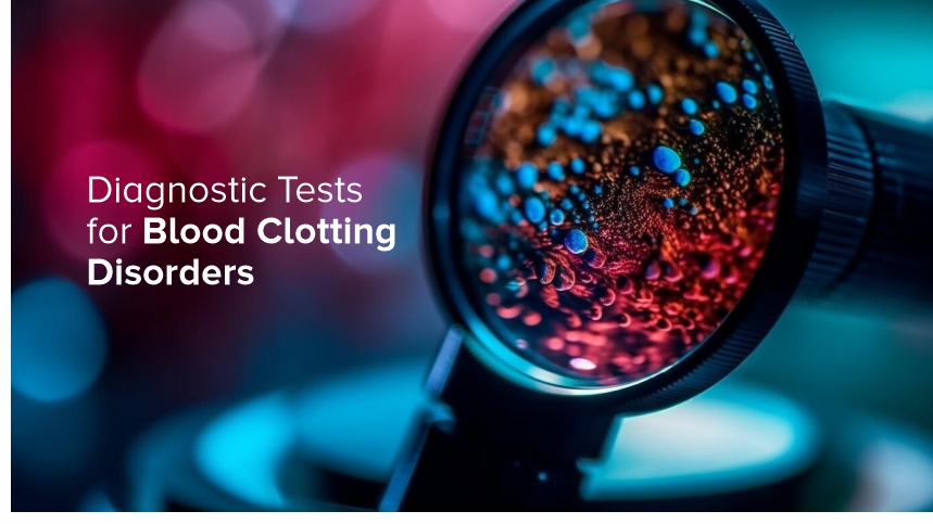 Diagnostic Tests for Blood Clotting Disorders