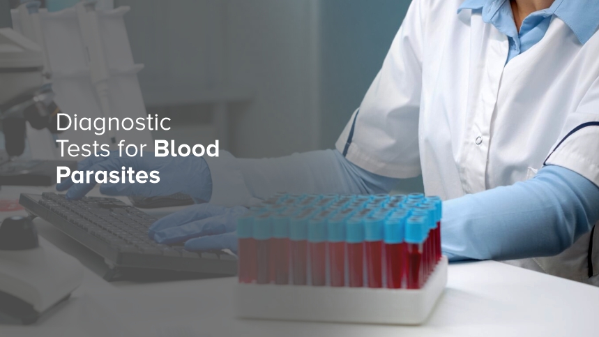 Diagnostic Tests for Blood Parasites