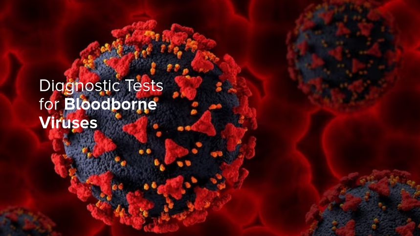Diagnostic Tests for Bloodborne Viruses