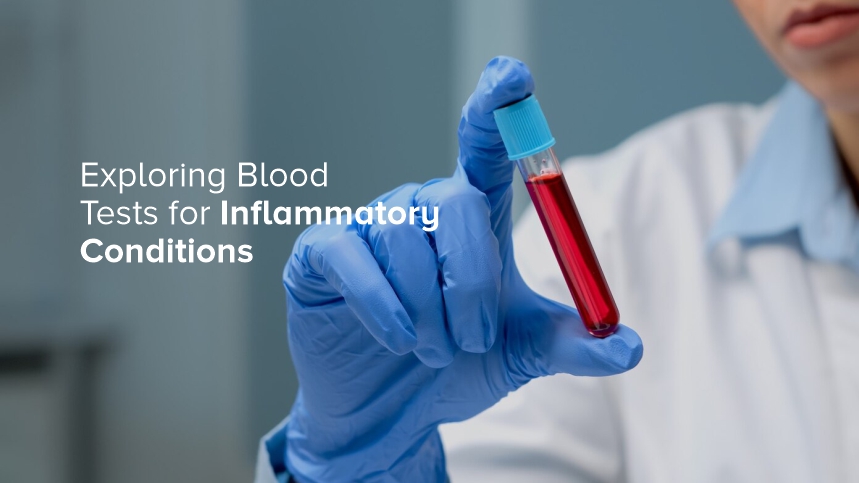 Exploring Blood Tests for Inflammatory Conditions