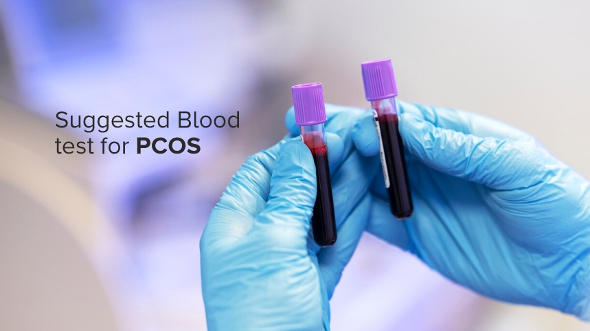 The Essential Blood tests to diagnose PCOS