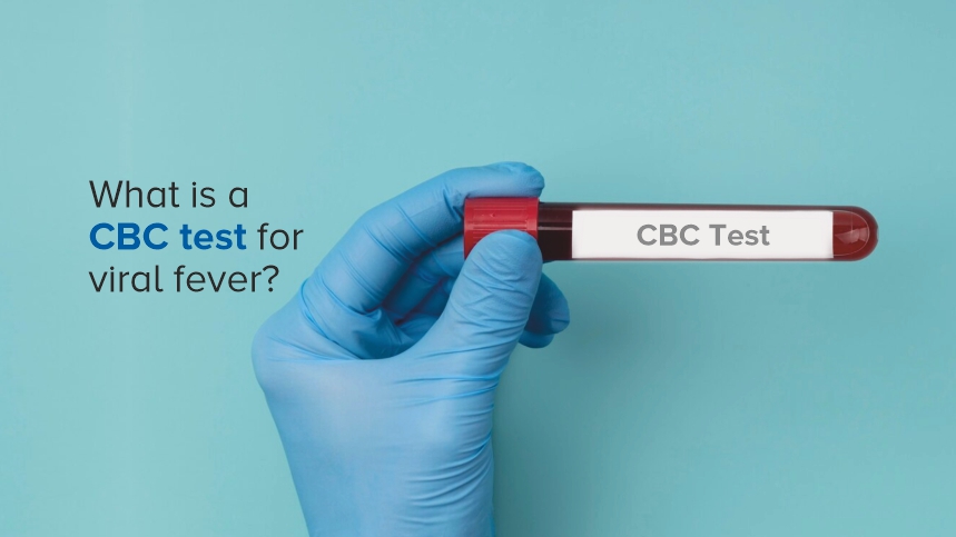 Understanding CBC Tests for Viral Fever