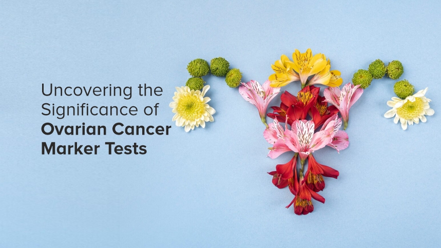 Uncovering the Significance of Ovarian Cancer Marker Tests