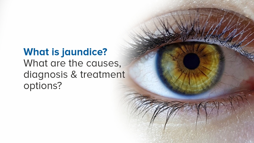 Understanding Jaundice: Causes, Diagnosis, and Treatment