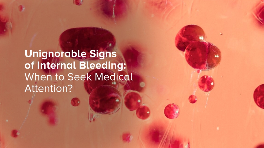 6 Unignorable Signs of Internal Bleeding: When to Seek Medical Attention?