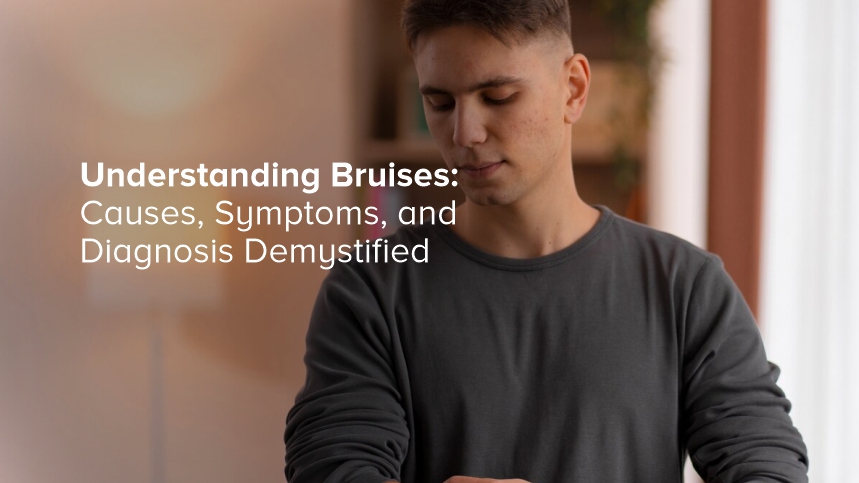 Understanding Bruises: Causes, Symptoms, and Diagnosis Demystified