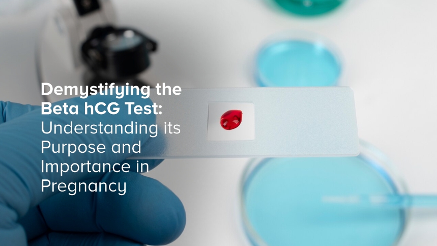 Demystifying the Beta hCG Test: Understanding its Purpose and Importance in Pregnancy