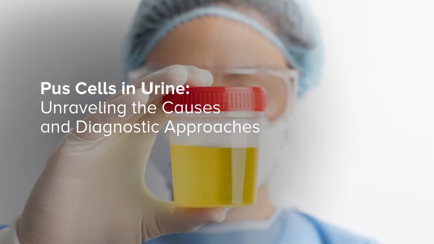 Pus Cells in Urine: Unraveling the Causes and Diagnostic Approaches