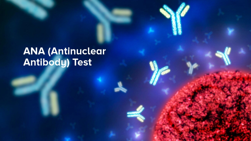 Understanding the ANA (Antinuclear Antibody) Test: A Comprehensive Guide