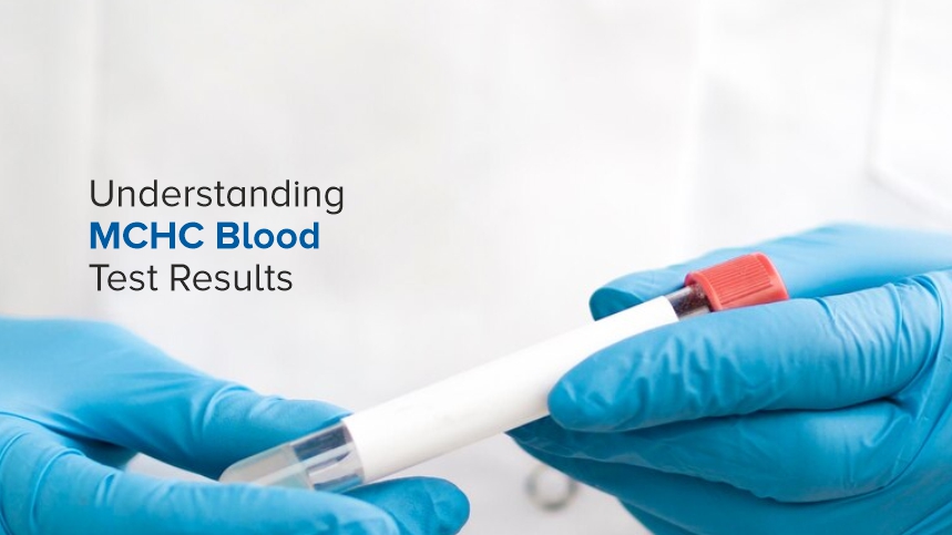 Understanding MCHC Blood Test Results: A Comprehensive Guide