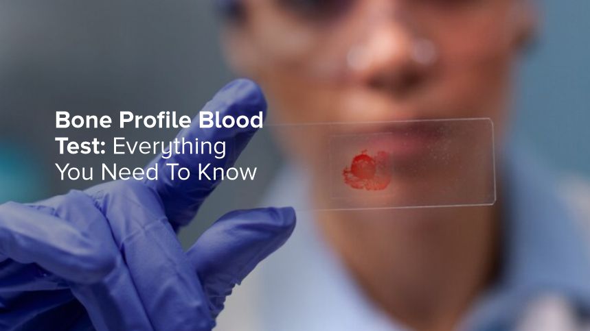 Bone Profile Blood Test - Everything You Need To Know