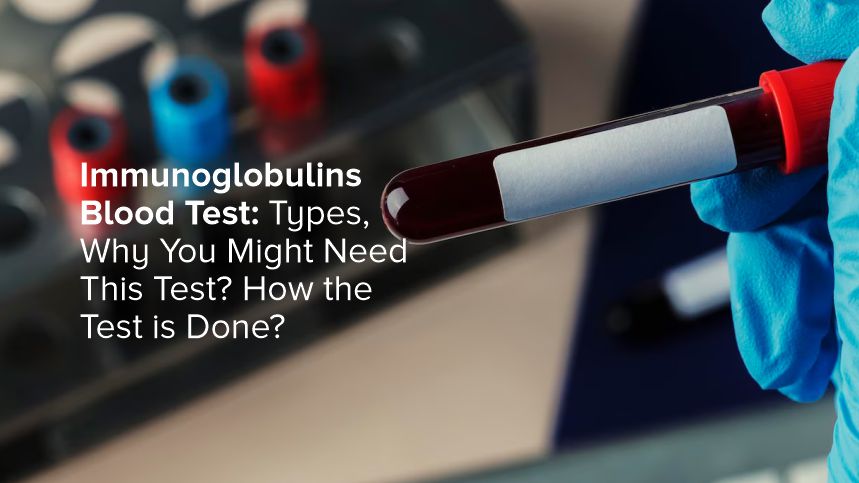 Understanding Immunoglobulins Blood Test: A Comprehensive Guide