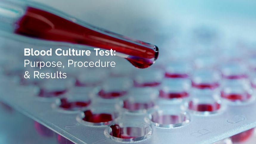 Blood Culture Test: Purpose, Procedure & Results