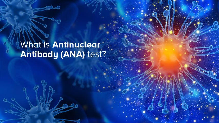 What is the Antinuclear Antibody (ANA) Test? A Comprehensive Guide