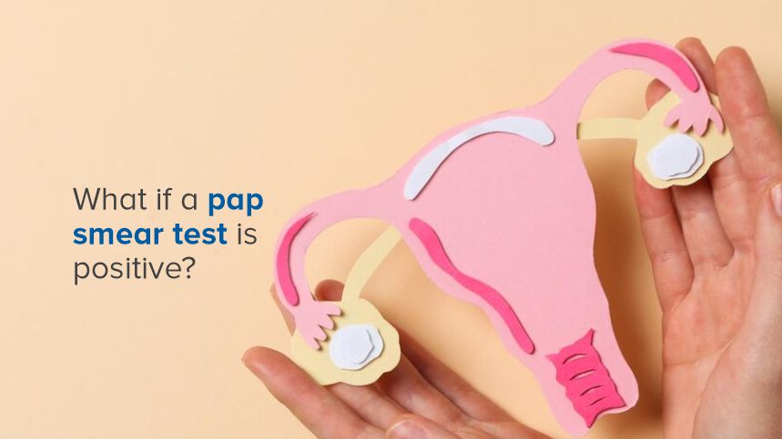 What Does a Positive Pap Smear Mean?