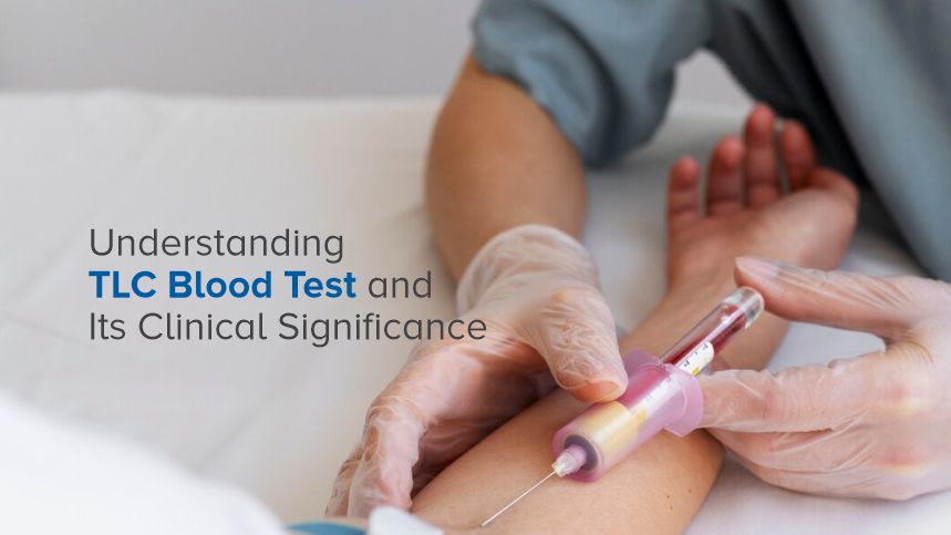 Unveiling the Secrets of the TLC Blood Test for Your Health