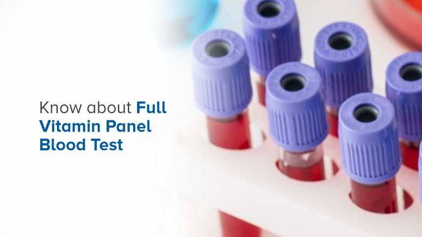 The Hidden Benefits of a Full Vitamin Panel Blood Test