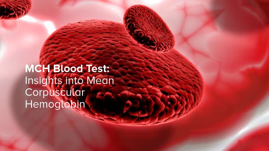 Demystifying the MCH Blood Test – Your Ultimate Guide to Mean Corpuscular Hemoglobin
