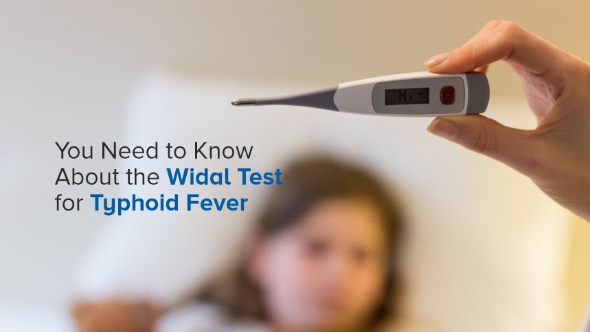 The Widal Test for Typhoid Fever You Really Should Know About