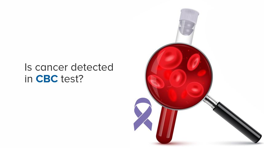 Can a CBC Test Detect Cancer? Unveiling the Truth About Blood Tests