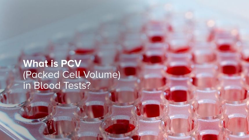 Understanding Packed Cell Volume (PCV) in Blood Tests